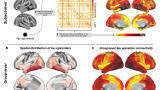 Detangling tau: Patient scans reveal how amyloid and tau proteins work in tandem in Alzheimer’s disease