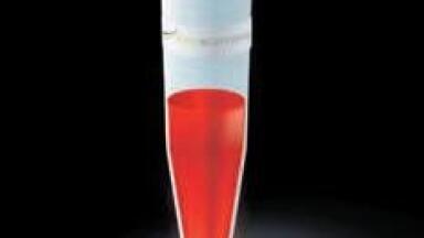 Run PCR Directly from Whole Blood
