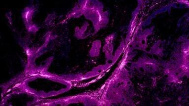 Defined hydrogel enables reliable cancer cell culture in xenograft models
