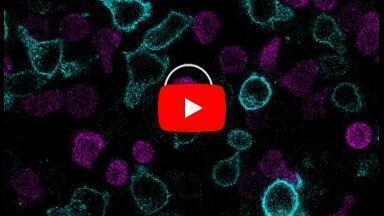 CAR-T cells can transfer antitumour immunity to other T cells by exchanging surface proteins