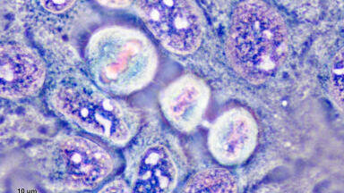 Breakthrough and controversy: the scientific and ethical legacy of Henrietta Lacks and her immortal HeLa cells