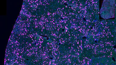 New Anti-GFP antibodies enhance fluorescent protein detection