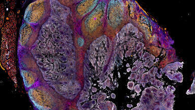 New spatial imaging system advances tissue proteomics research
