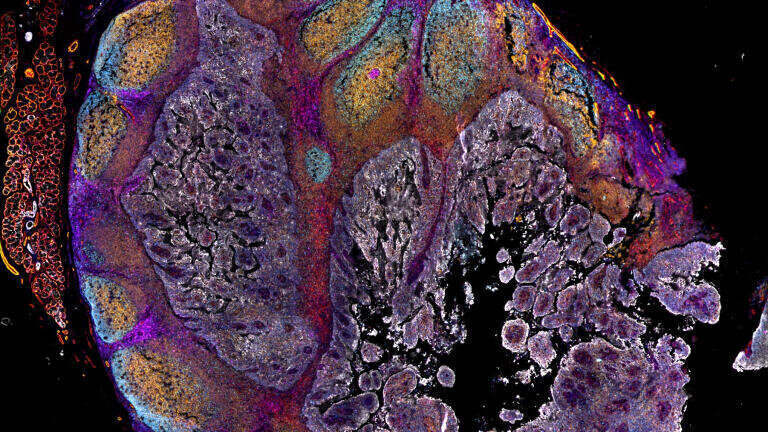 New spatial imaging system advances tissue proteomics research