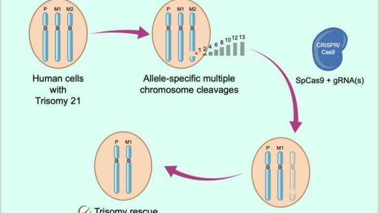 CRISPR technique used to remove extra chromosomes in trisomy cell line proof-of-concept
