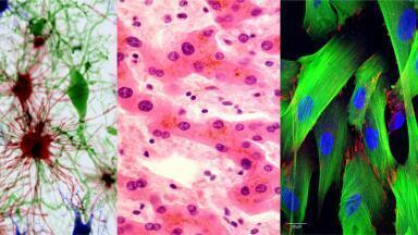 Ready-to-use hiPSC-derived cells streamline lab workflows