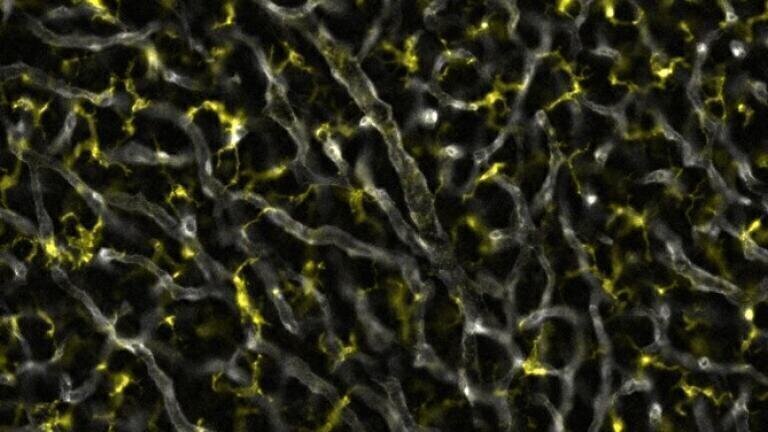 Macrophages, marked in yellow, mingling with the vasculature (grey) in the mouse pituitary gland. Scale is 50 µm. Photo: Henna Lehtonen