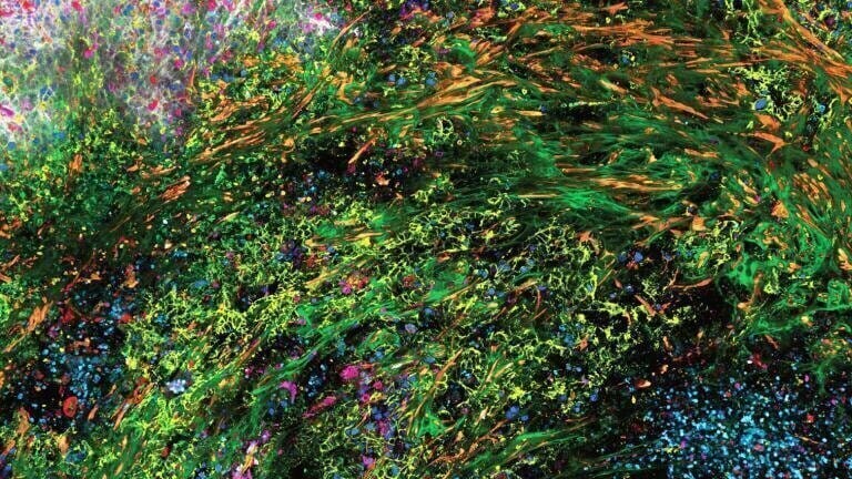 Advancing 3D spatial analysis with high-multiplex imaging
