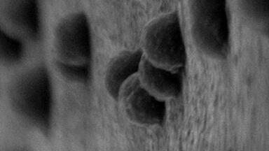 Copper nanotech coating could make implants infection-proof