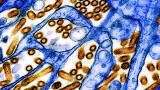 Viewpoint: Prepare now for a potential H5N1 pandemic