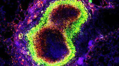 Texas Biomed's candidate TB vaccine provides full cover in primates study