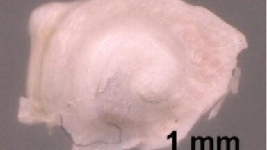 Novel terahertz imaging technology shows structural details of cochlear  