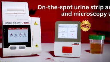Transforming urinalysis: Faster, smarter, more precise
