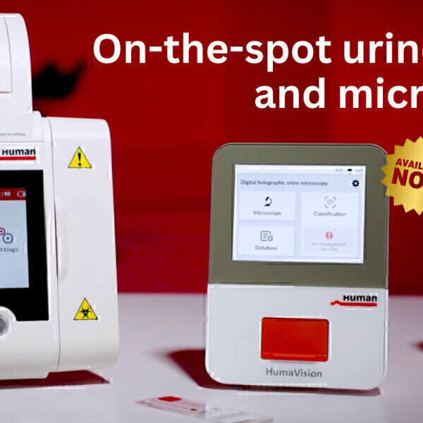 Transforming urinalysis: Faster, smarter, more precise Labmate Online