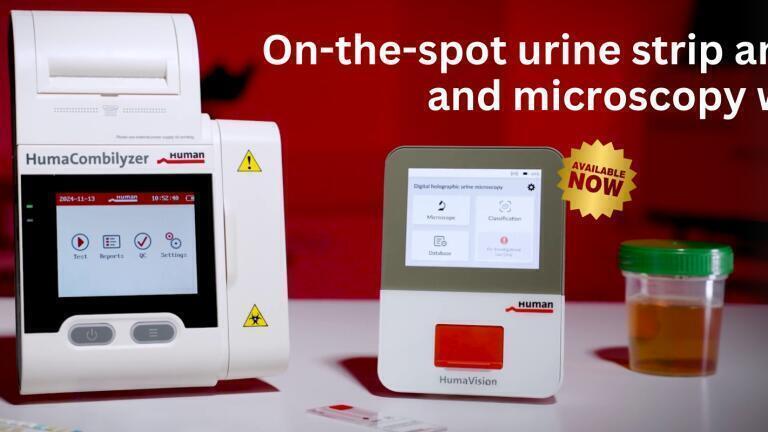 Transforming urinalysis: Faster, smarter, more precise