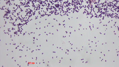 Parade of pathogens: antimicrobials produced by drug-resistant bacteria kills competitors