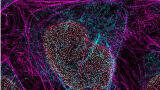 Acquisition to advance imaging and research solutions