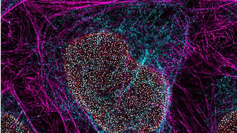 Acquisition to advance imaging and research solutions