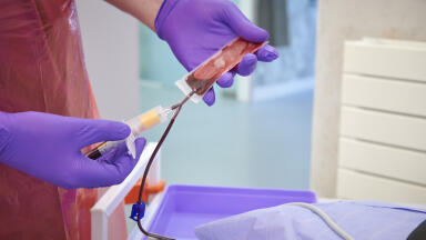 Tailored human biospecimens for biomedical discovery