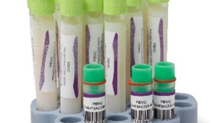 PBMC vials for immunology and oncology research.