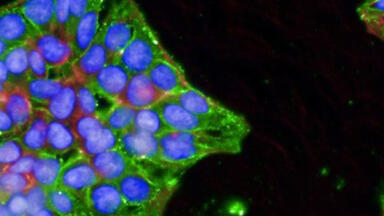 Accelerating glycobiology research with Heparan Sulfate antibodies