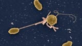 Ethiopian holy water linked to Europe-based patients with multi drug-resistant type of cholera