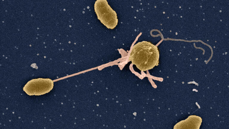 Ethiopian holy water linked to Europe-based patients with multi drug-resistant type of cholera