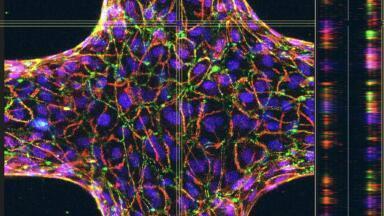 Bioengineered blood vessels shed light on trypanosome tactics