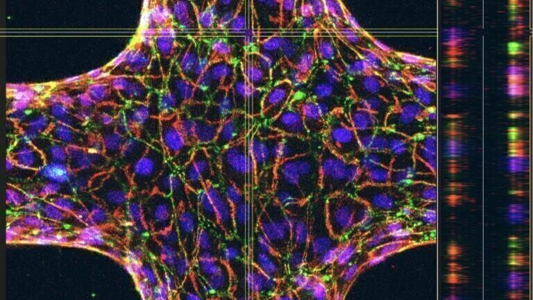Bioengineered blood vessels shed light on trypanosome tactics