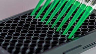 Ready-to-use DUB assay kits for targeted enzyme analysis