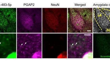 MicroRNA miR-483-5p found to ease anxiety in response to stress