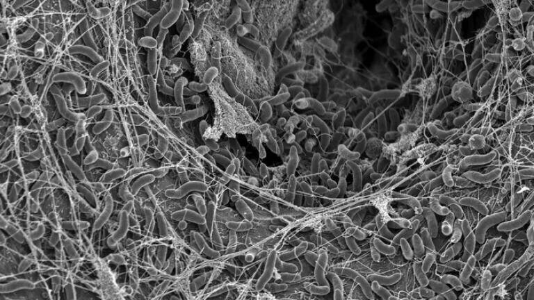 How the cholera bacterium can outsmart a virus