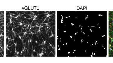 Fast-track neural cell production with iPSC differentiation kits