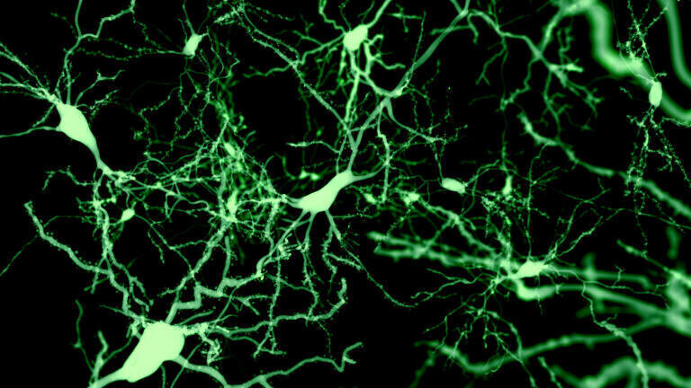 Neurons marked by Fluorescence.