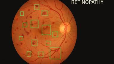 Wide-field, quantitative OCT angiography with spectrally extended line field technology