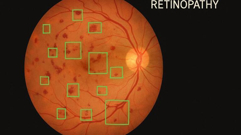 Wide-field, quantitative OCT angiography with spectrally extended line field technology