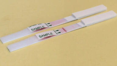Rapid test speeds diagnosis of deadly mucormycosis after pandemic surge 