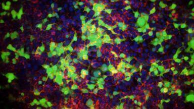 High-performance transfection reagent for diverse cell lines 
