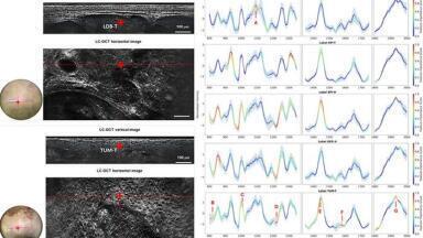 Dual-mode optical imaging system enables noninvasive skin cancer characterisation