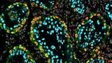 iPSC protocol advances research into male infertility treatments