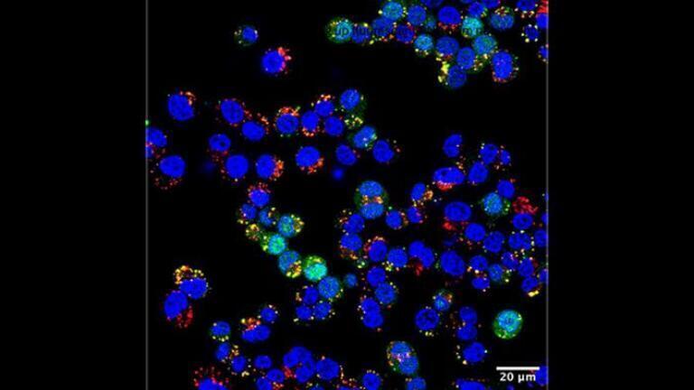 Researchers designed nanoparticles that can self-assemble at room temperature and deliver RNA (green) to living cells (nuclei shown in blue), offering a new pathway to vaccine and biologic drug design. Credit: Courtesy of Hossainy et al.