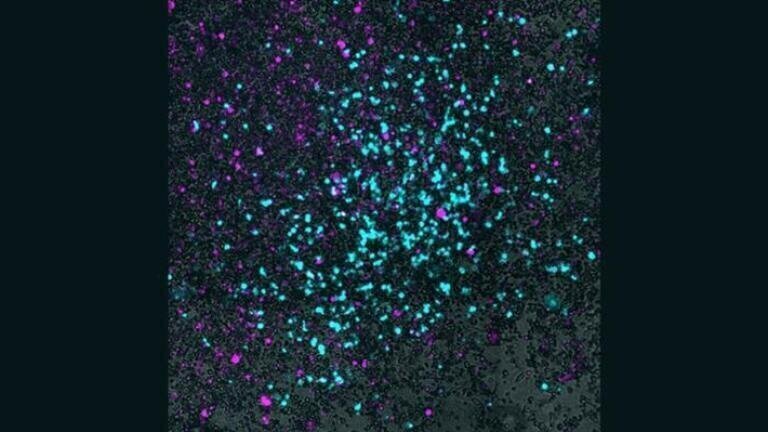 In this microscopic image, grey indicates small cell lung cancer cells, magenta shows Salmonella that have entered the cancer cells, and cyan reveals the virus spreading outward in a circular pattern from the center of the culture. Credit: Danino Lab