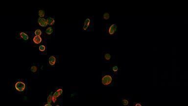 Discovery of platelet protein could reduce heart attack and stroke risk in people with type 2 diabetes