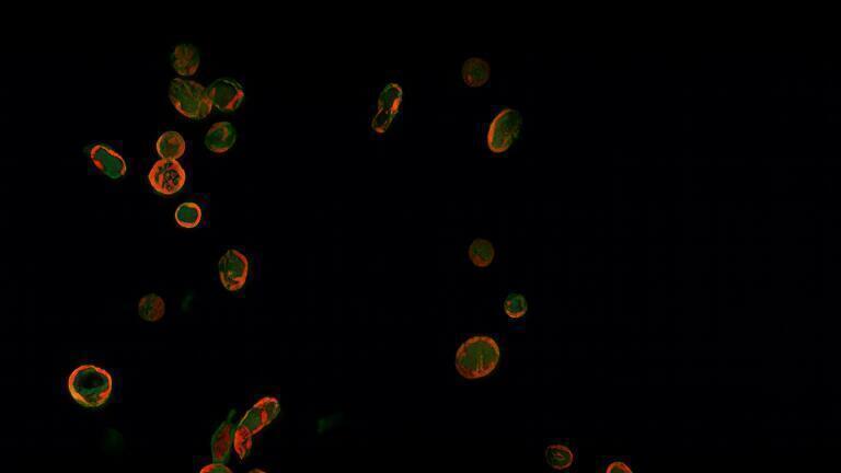 Discovery of platelet protein could reduce heart attack and stroke risk in people with type 2 diabetes