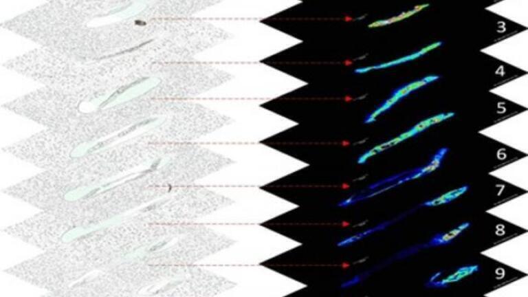 Ten consecutive tissue sections from a single C. elegans nematode, shown as optical images (left stack) and corresponding lipid distribution maps generated by MALDI mass spectrometry imaging (MSI) (right stack). This sectional data enabled 3D reconstruction of lipid localization, highlighting organ-specific fat distribution along the body axis. Credit: Sara Mandic from Okayama University, Japan