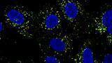 Dengue rewires immunity, shaping vaccine response