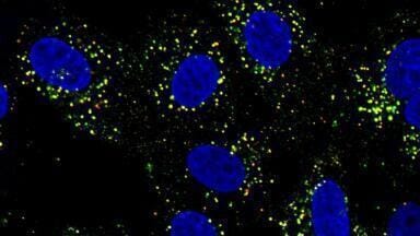 Dengue rewires immunity, shaping vaccine response