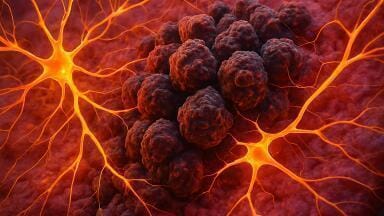Lung cancer cells in the brain form synapses with neurons to drive tumour growth
