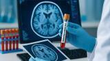 Alzheimer’s blood test trial in the UK could transform diagnosis and speed access to treatment