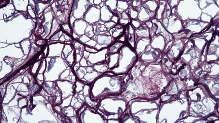 Millions with hepatitis B may avoid routine liver cancer checks